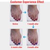 Bunion Corrector Silicone Toe Sleeves and Separator - Pain Relief & Alignment