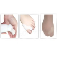 Bunion Corrector Silicone Toe Sleeves and Separator - Pain Relief & Alignment